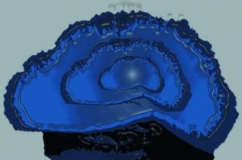 gut-brain axis
