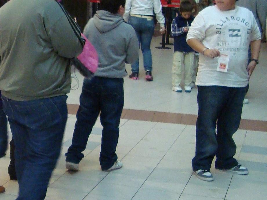 childhood obesity