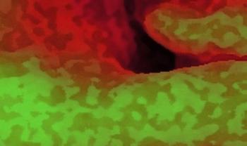 gut health