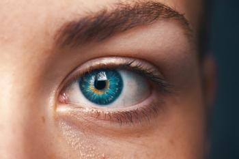 eye photo