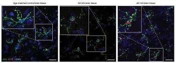 Credit: Nature (2024). DOI: 10.1038/s41586-024-07185-7   