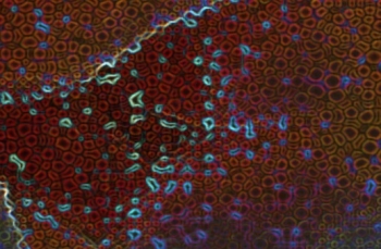 Gut Biome