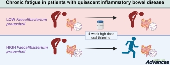 Graphical abstract. Credit: Gastro Hep Advances (2024). DOI: 10.1016/j.gastha.2024.08.012