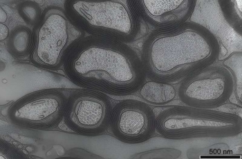 Credit: Wiebke Moebius, MPI Goettingen.      