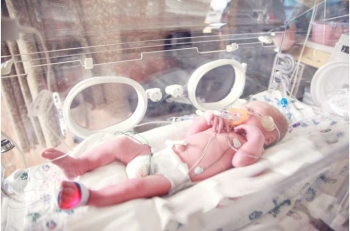 preemie - Credit Unsplash - CC0 public domain.jpg